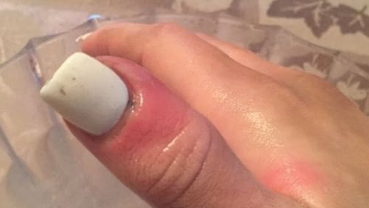 Replying to @littleravenwitch Beauty is pain, get with it- or get lost... |  nail pushed up to cuticle | TikTok